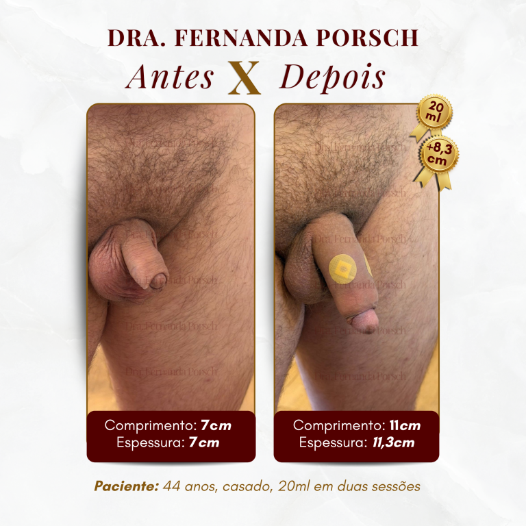 2 SITE - ANTES X DEPOIS