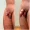 ANTES-E-DEPOIS-3