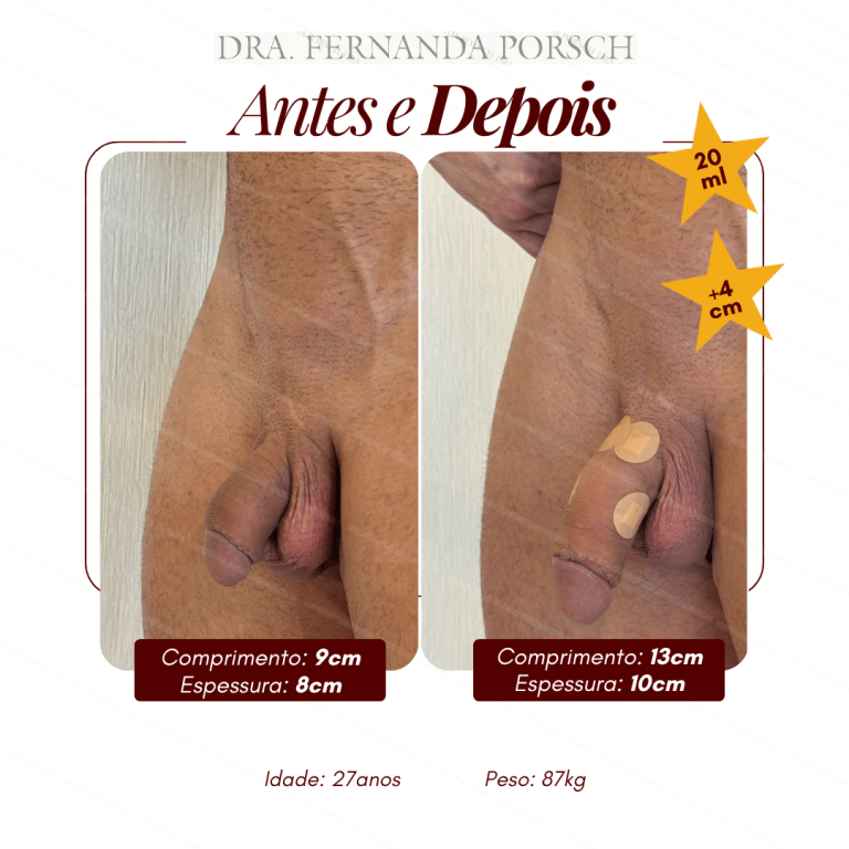 Comprimento 13cm Espessura 11,5cm (3)