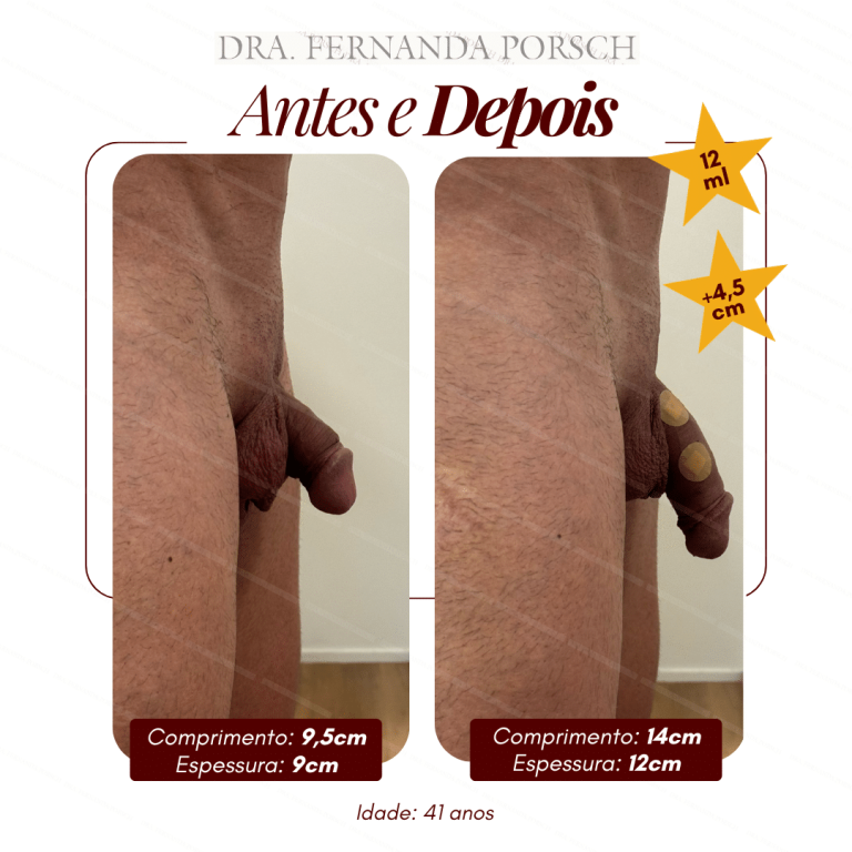 Comprimento 13cm Espessura 11,5cm (4)